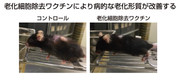 老化制御グループが開発した老化細胞を除去するワクチンがメディアで紹介、放映されました。